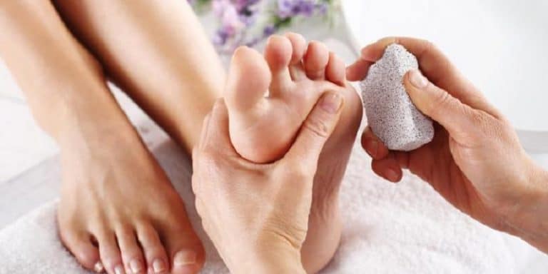 Comment soigner un œil de perdrix naturellement ? - Affaires du Jour